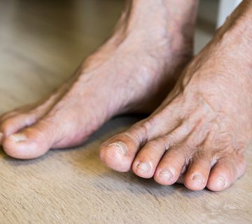 Perfect Fit Pedorthics Diabetes Footwear