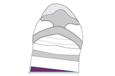 Wedge